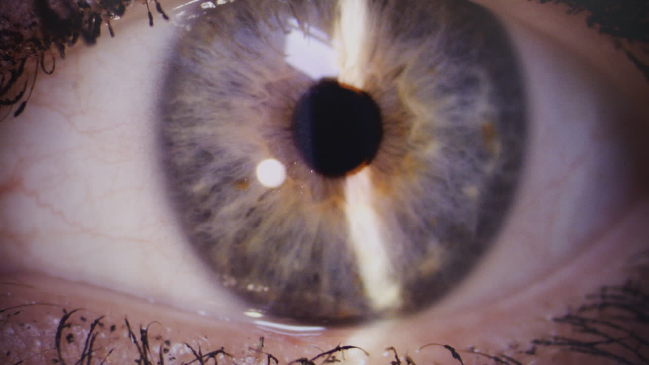 Closeup of Eye Retina and Pupil in Advanced Tech Eye Exam