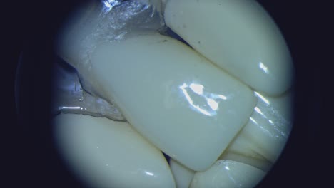 macro shot of teeth. circle view from microscope of patient's teeth. close-up.