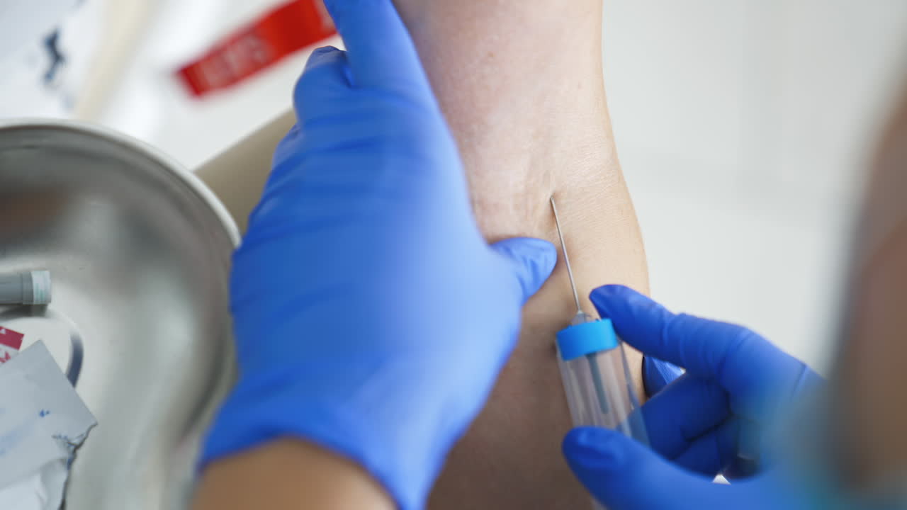 Blood sampling in the laboratory. Laboratory worker doctor takes a blood sample for analysis. Procedure of taking blood in clinic. Close-up.