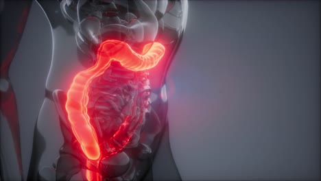 examen de radiología del colon humano