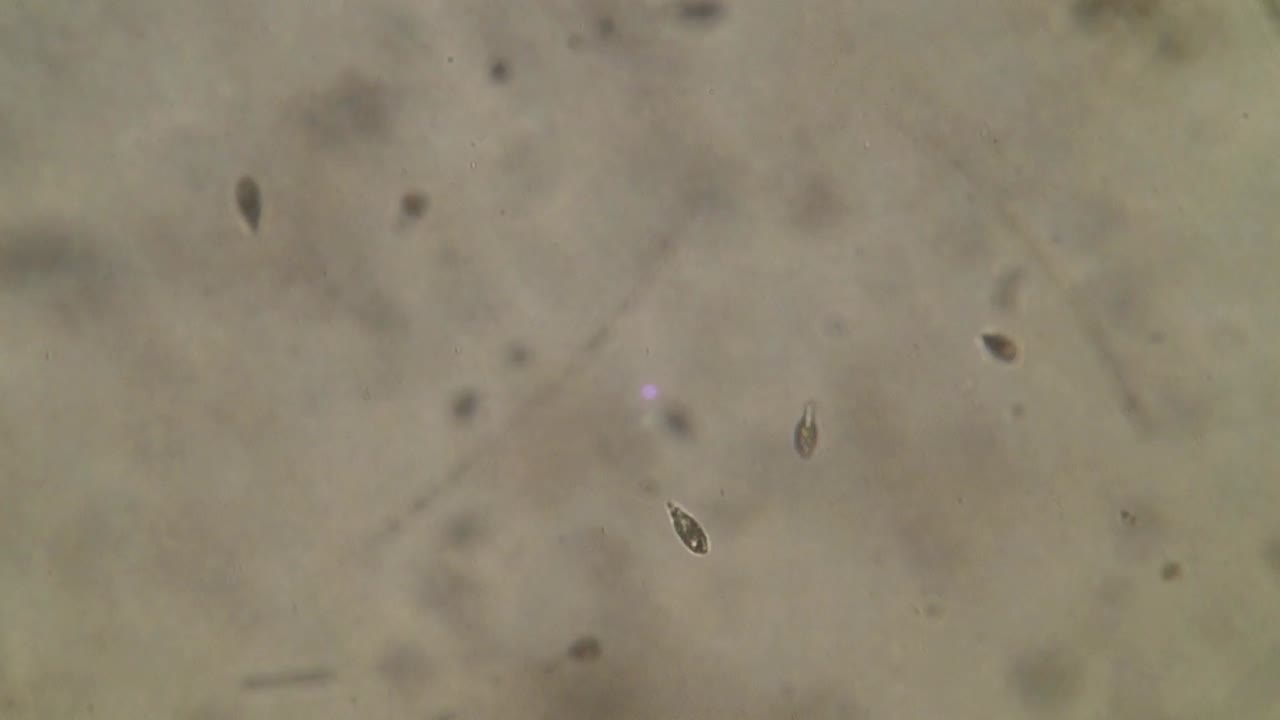 microorganismos en una gota de agua no potable