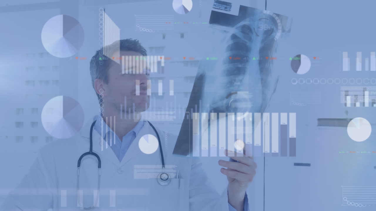 Animação de processamento de dados sobre médico caucasiano segurando raio-x