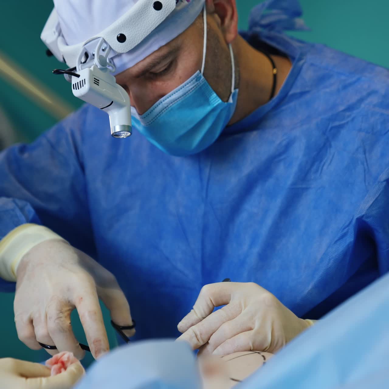 Surgeon and nurse working at operation. Medics wearing the caps, masks and glasses performing breast implantation surgery