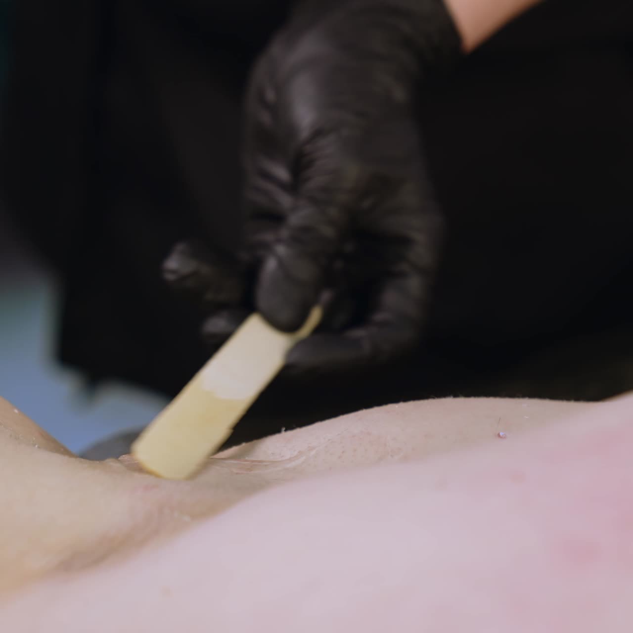 Gennemsigtig gel smøres under mandens armhule. Forberedelse til laser epilering. Tæt på.