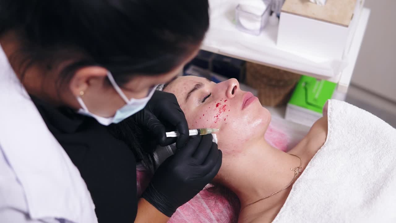 Rejuvenating procedures: professional cosmetologist makes multiple injections in woman's face skin during mesotherapy