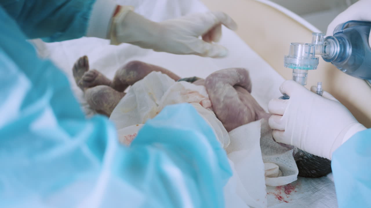 recién nacido que recibe asistencia respiratoria