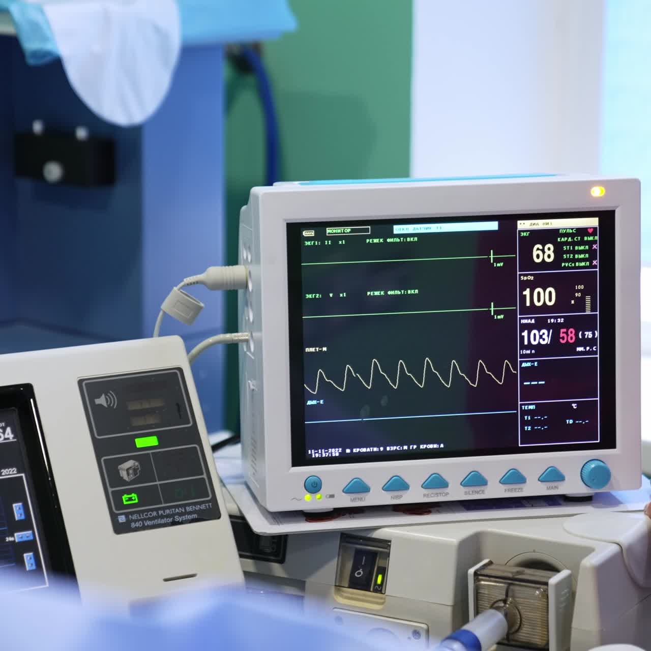 Monitors of modern medical equipment working during operation. Heart ...