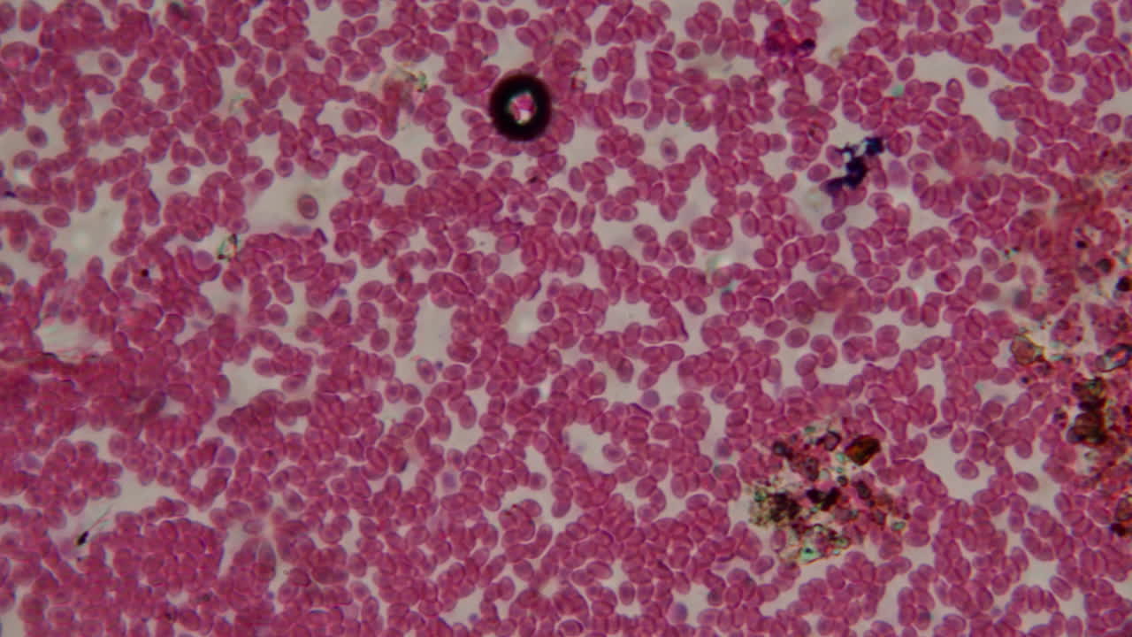 Globuli rossi umani che scorrono al microscopio