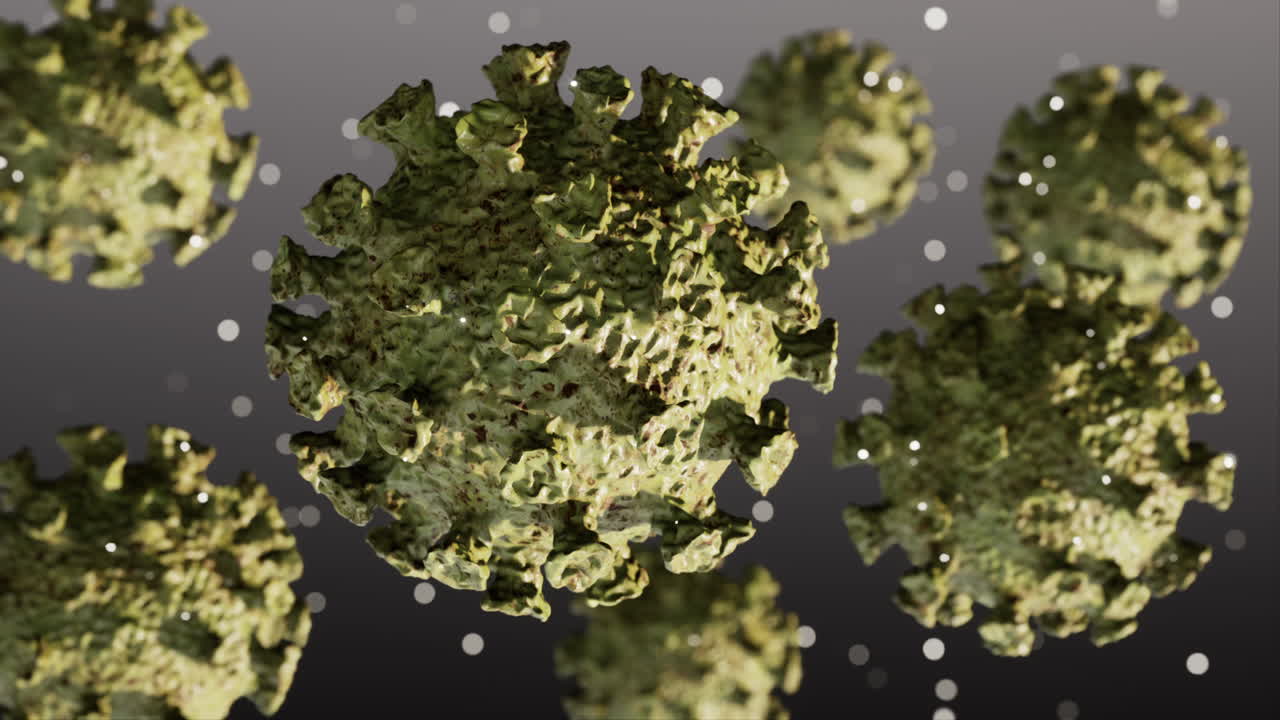 심각한 급성 호흡기 코로나-19의 현실적인 영상