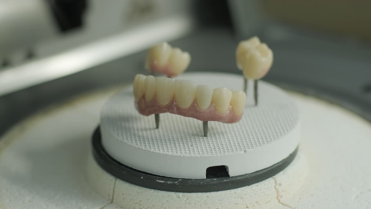 horno de cerámica dental para el procesamiento de coronas dentales