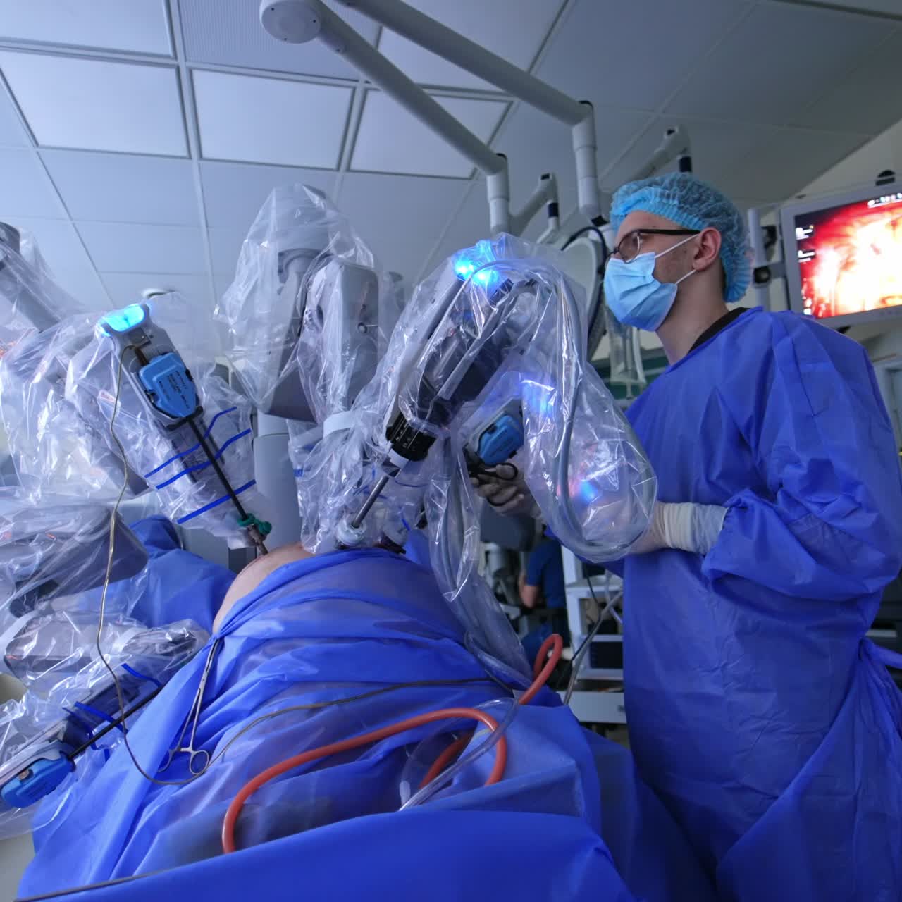 Abdominal minimal invasion operation conducted by a futuristic robot. Da Vinci equipment performing surgery. Male surgeon controlling the process