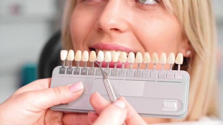 Part of dentist choosing color teeth from palette