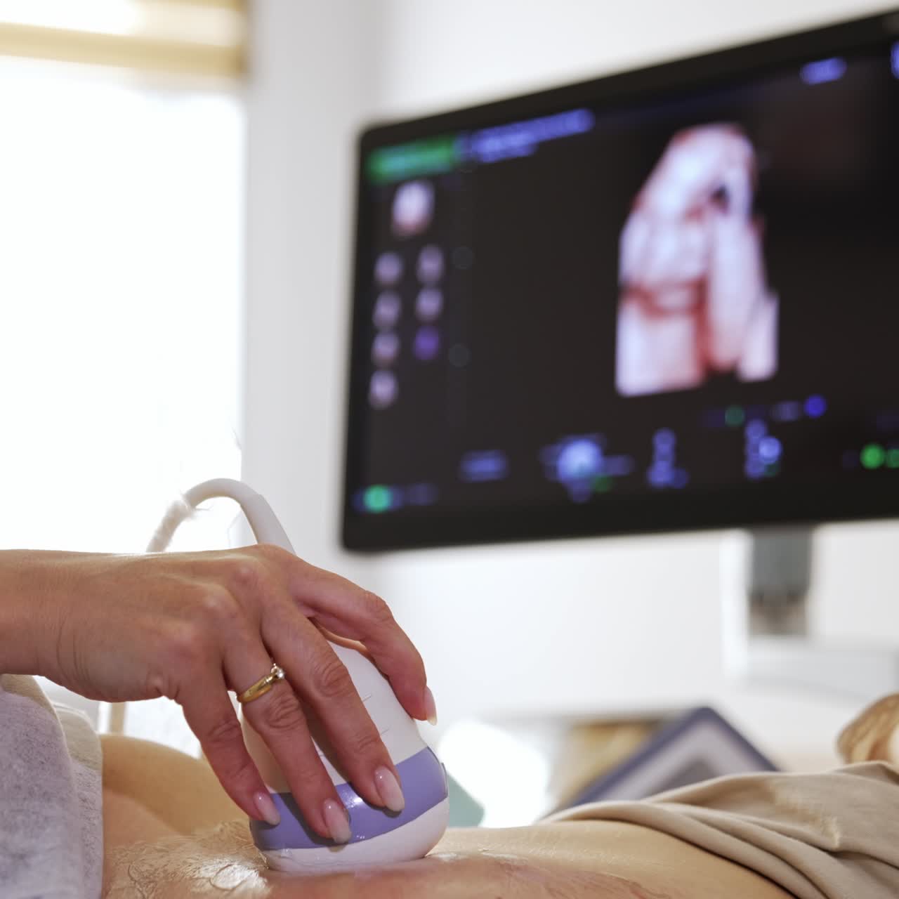 Ultrasound transducer in the doctor's hand moving by the belly. Black screen with baby image at backdrop in blur