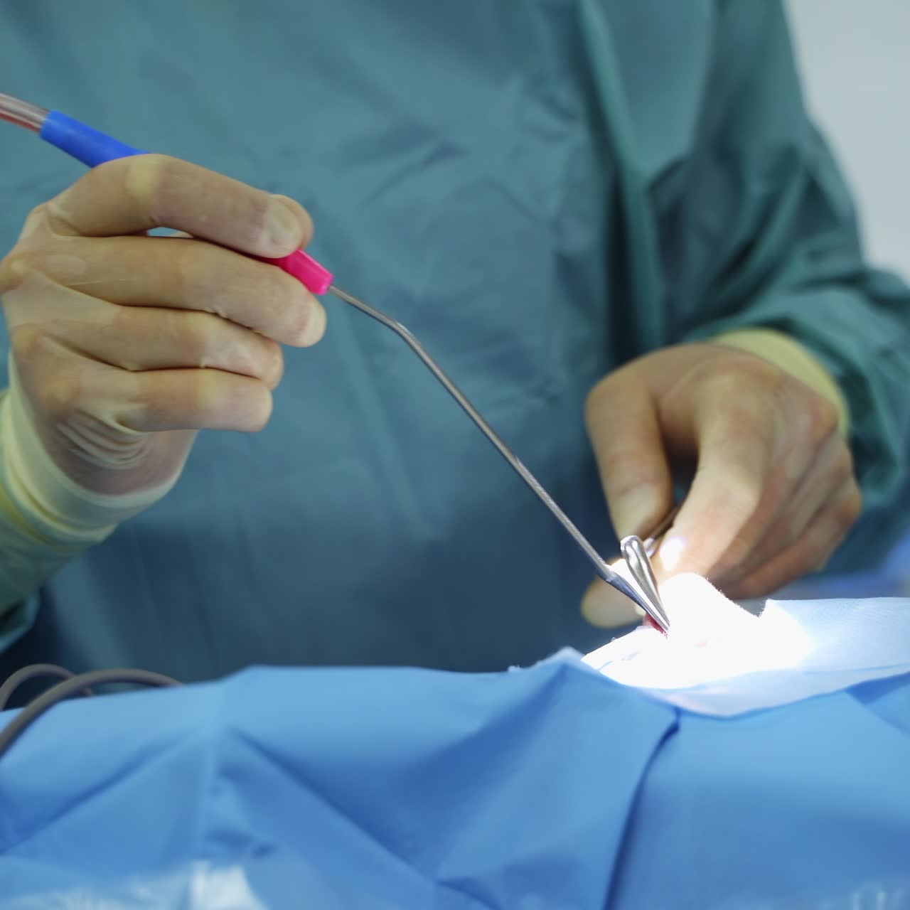 Surgeon's hands in gloves input the device with long attached tube into patient's nose. Blood moves by the tube of instrument. Close up