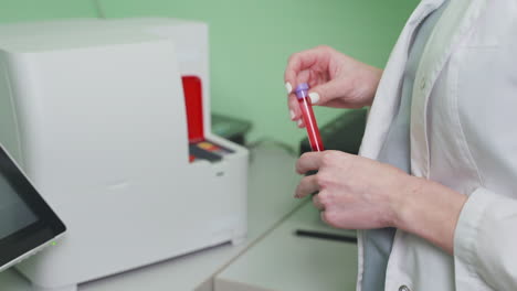 blood test procedure in a medical laboratory