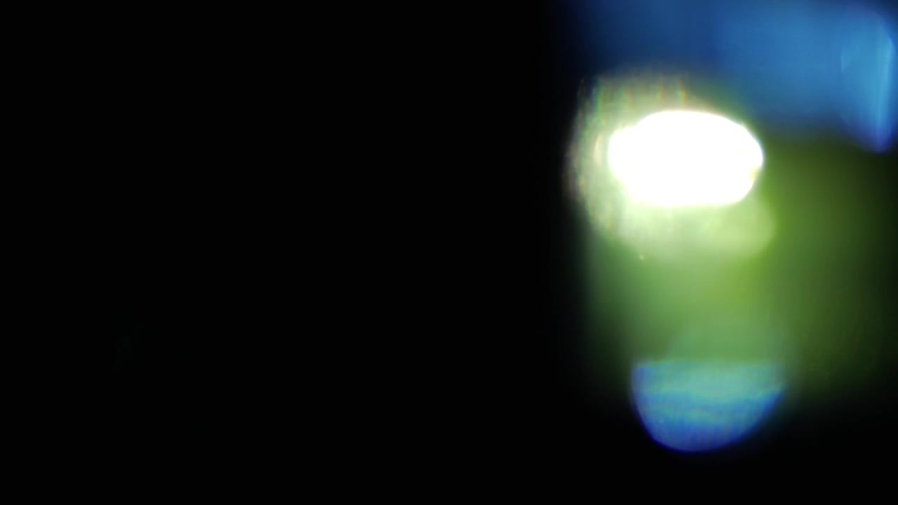 Dynamic Blue and Green Light Leaks with Lens Flares