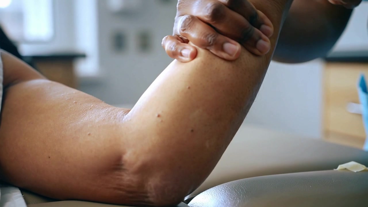 Terapeuta con camisa azul sujetando el brazo derecho del paciente, levantando su codo sobre una mesa acolchada.