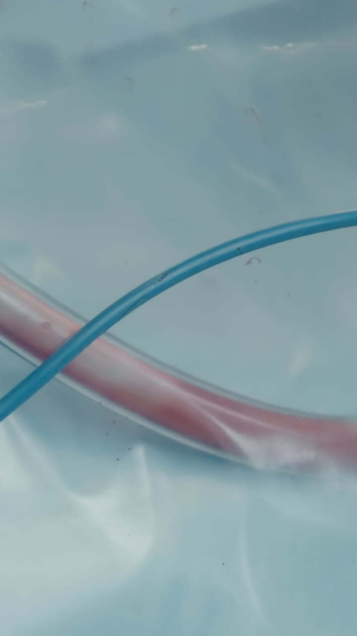 Cardiopulmonary bypass tubing in clinic. Part of heart-lung machine takes over function of heart with lungs circulating and oxygenating blood