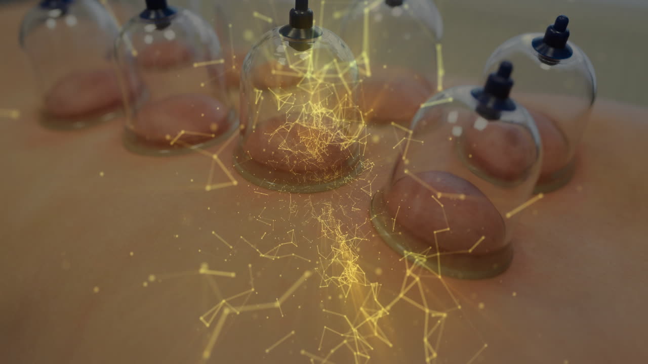 Adult woman receiving glass cupping therapy in clinic, showing glowing yellow digital mesh overlay