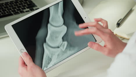 veterinary x-ray of horse's leg