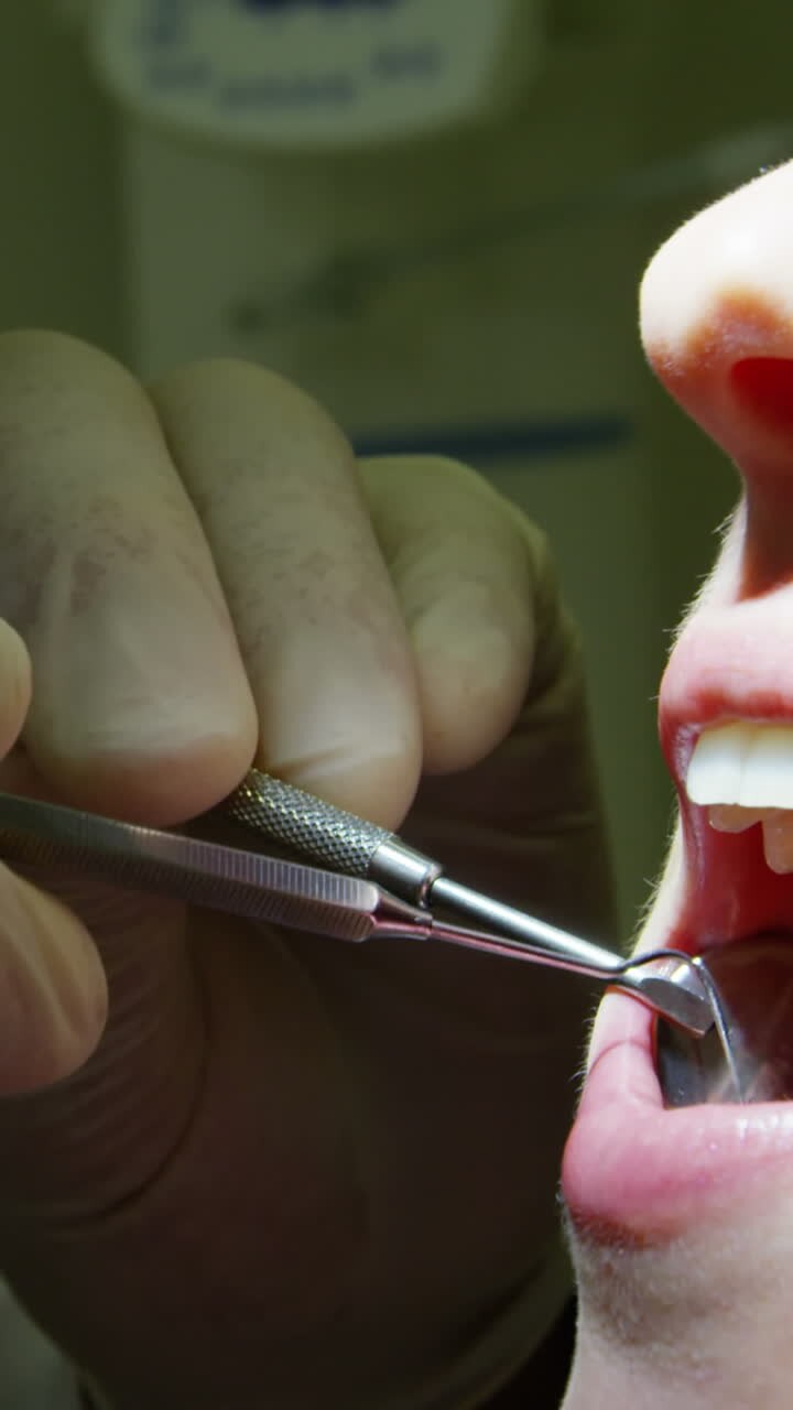 Dentist examining a female patient with tools