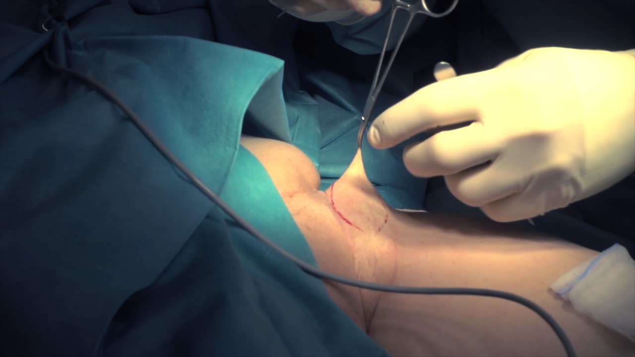 의사가 수술을 하다