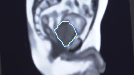mri scan of abdomen