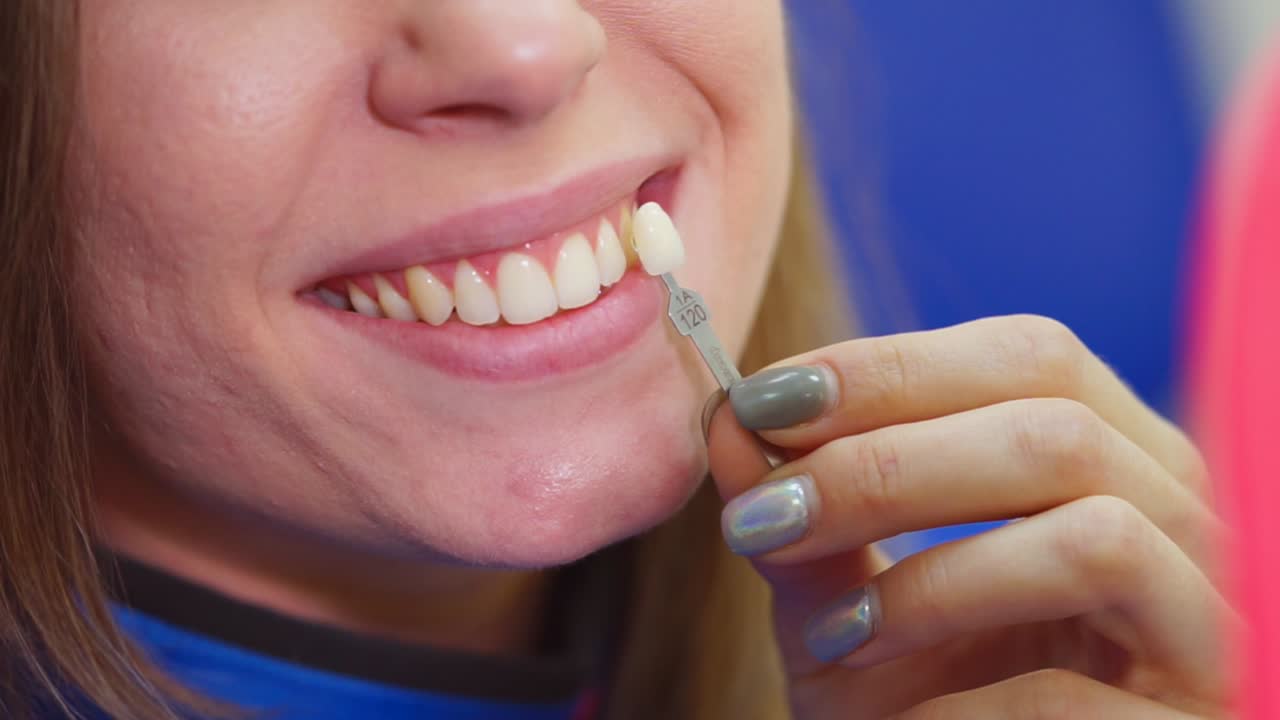 Teeth Whitening Procedure