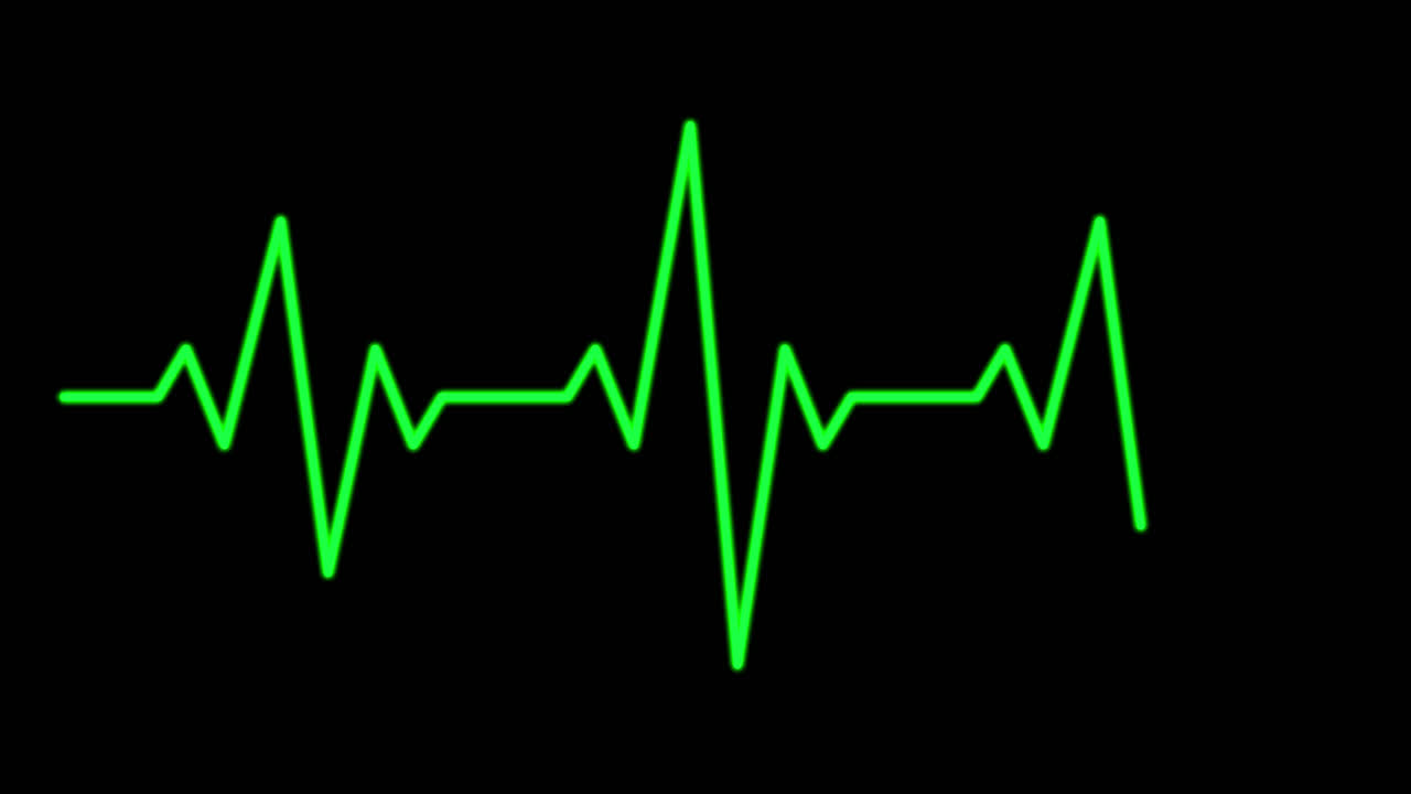Animeret grøn EKG-linje med puls på sort baggrund