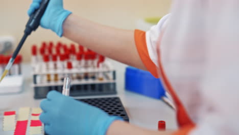 laboratory worker is putting tubes with blood on a rack. hands of a female nurse in sterile gloves working with vials on the table in a laboratory. close-up.