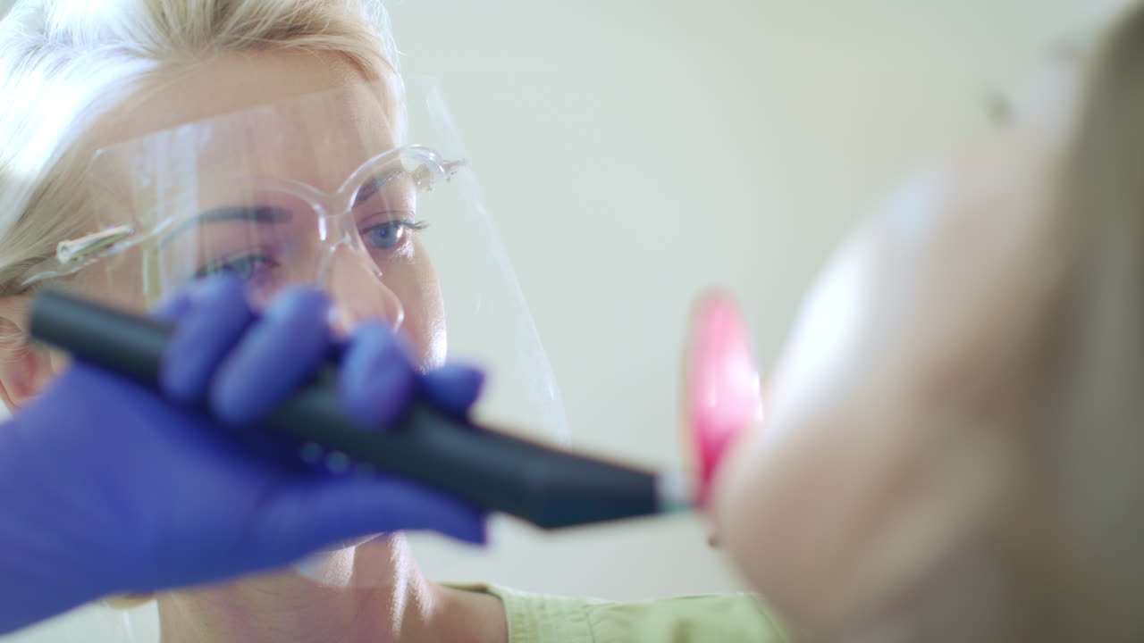 Dental composite polymerization procedure