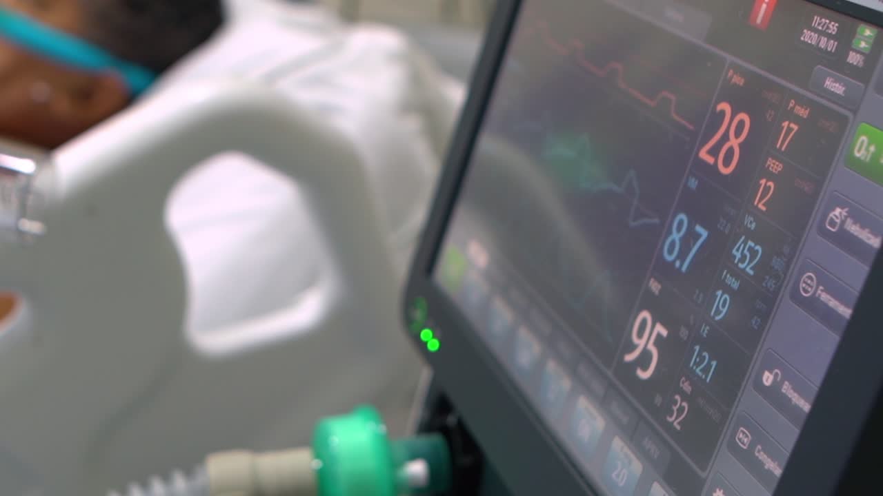 Un monitor traccia i segni vitali del paziente con variante brasiliana P1 del COVID-19 a letto, collegato a un respiratore.