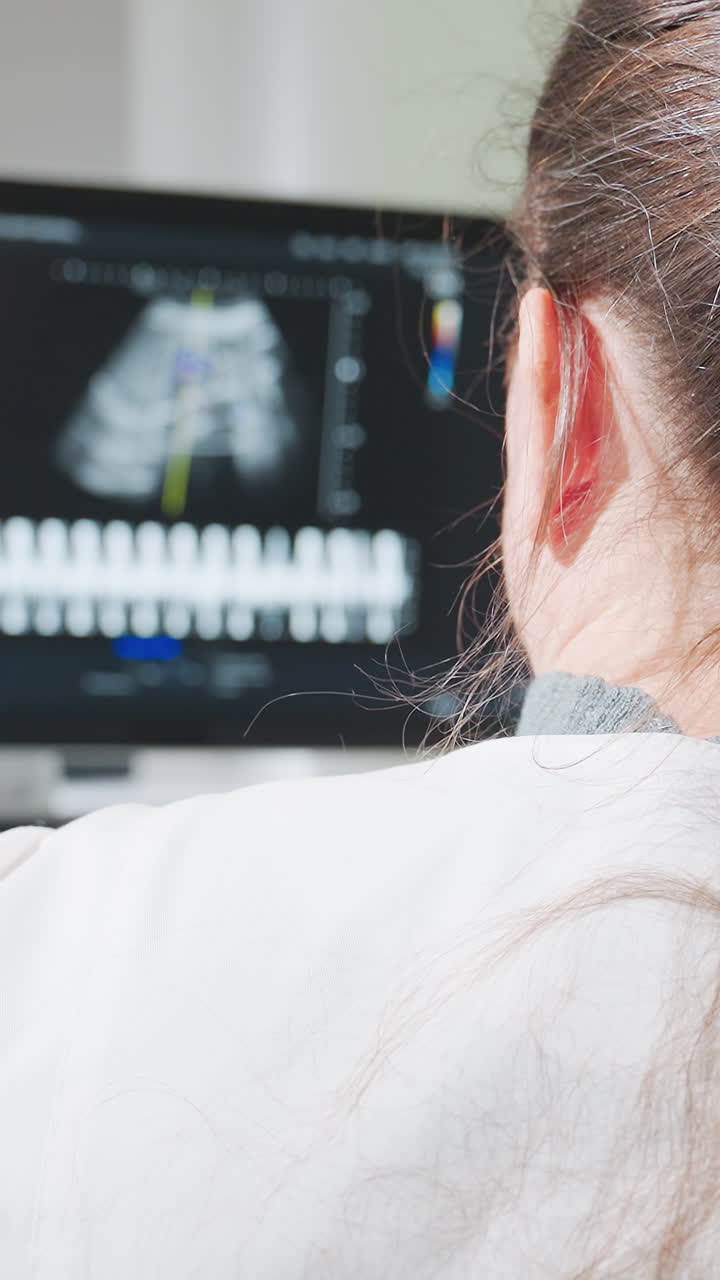 médico caucásico controlando la pantalla de ultrasonido fetal durante una revisión prenatal, matrona consultando con la paciente mientras el obstetra interpreta la forma de onda Doppler, enfermera registrando las constantes vitales, iluminación cálida