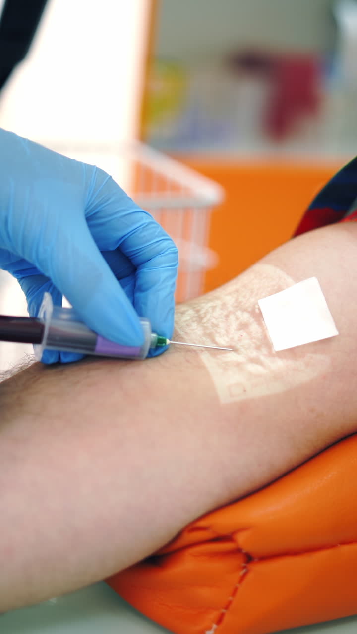 Nurse taking blood sample from vein. Close-up worker's hands in sterile gloves collecting blood with syringe into vial from patient's arm. Healthcare concept. Vertical video
