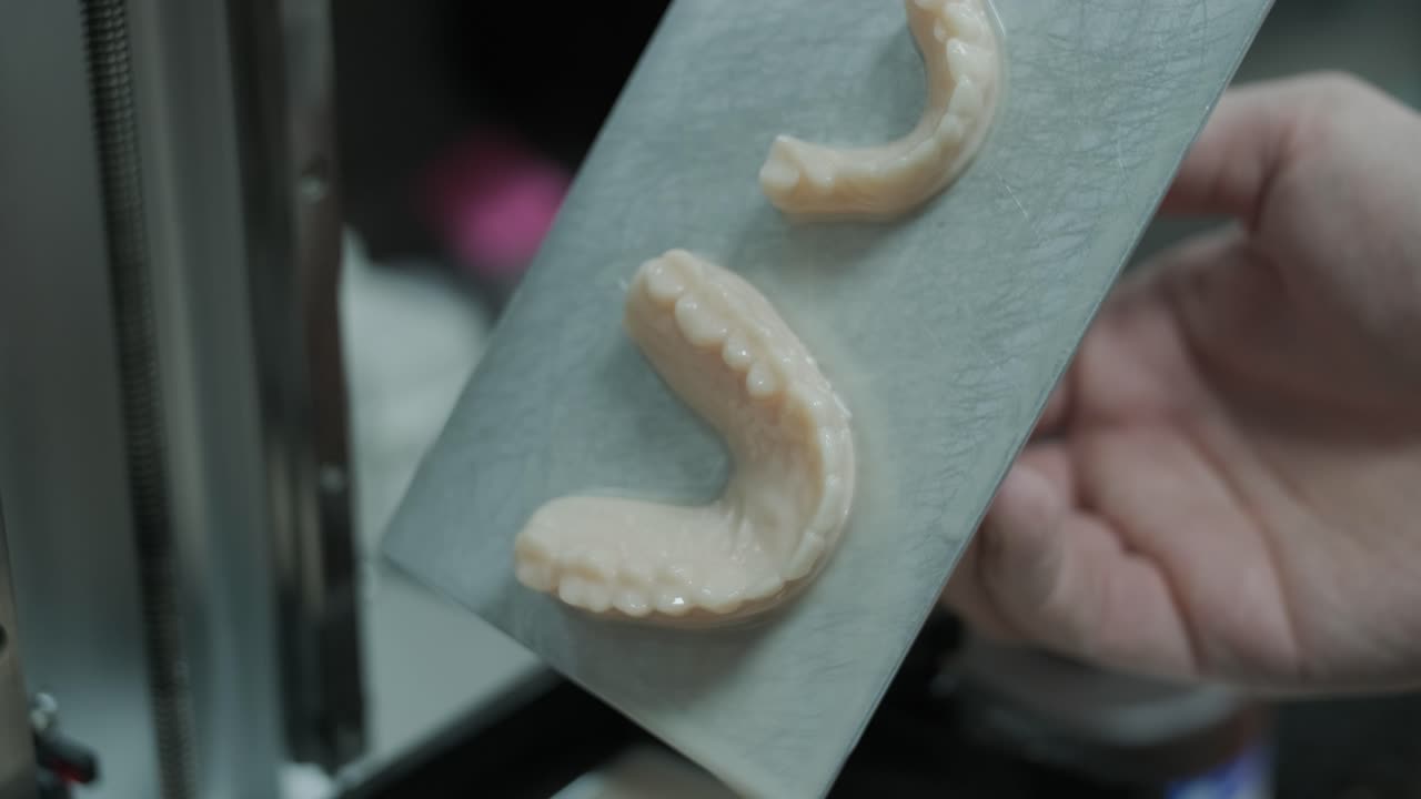 3D Printed Dental Crowns and Bridges in Post-Processing