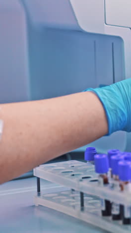 close-up of female hands filling the tube with blood from the automated machine. technician uses laboratory equipment while working with samples in tubes indoors. vertical video