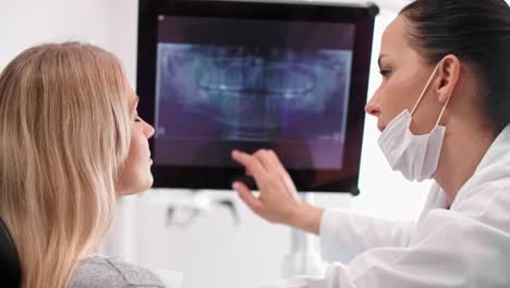 dentista femenina apuntando a la radiografía del paciente