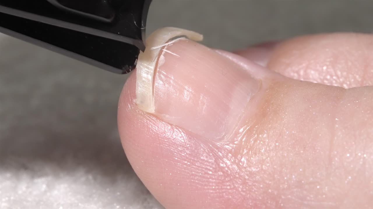 Side-angle close-up of a long big toenail being trimmed using a black nail clipper tool