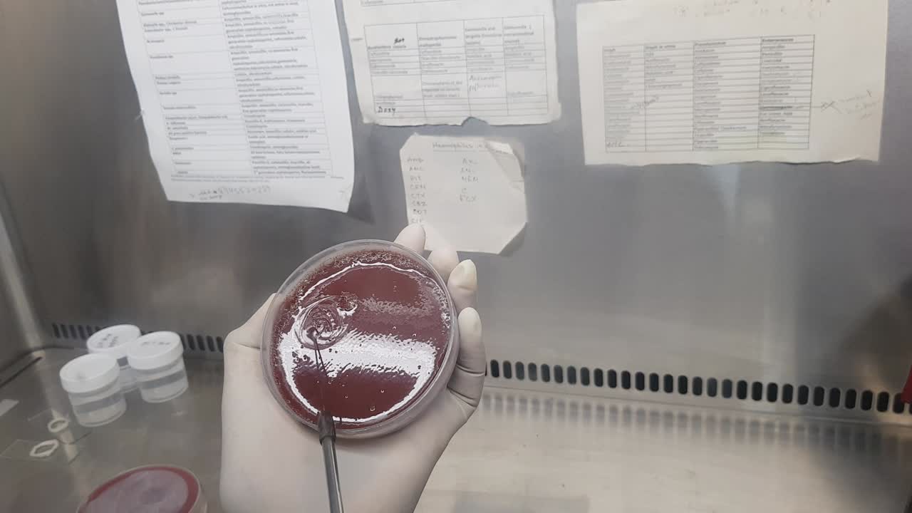 inoculación de la muestra en una placa de cultivo de agar de chocolate por medio de un bucle de inoculación.