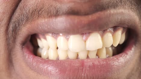 primer plano de la boca y los dientes de una persona