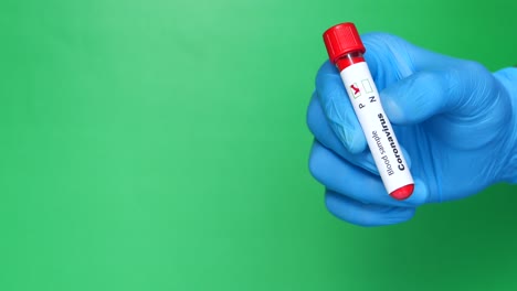 prueba de muestra de sangre de coronavirus
