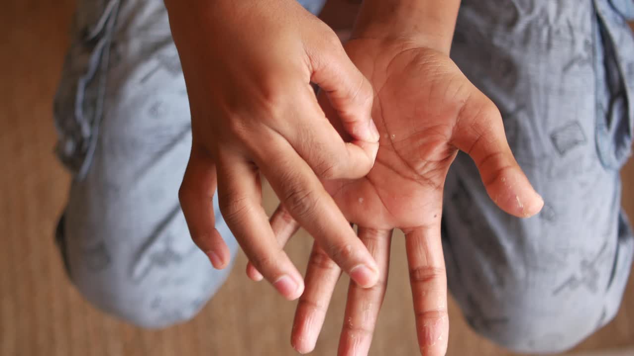 niño chequeando sus manos para el estado de la piel