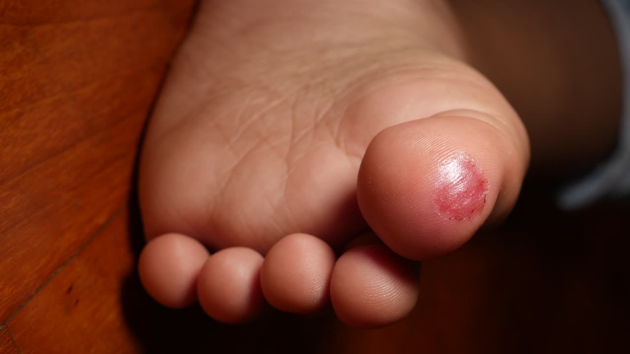 Piede di bambino con ferita