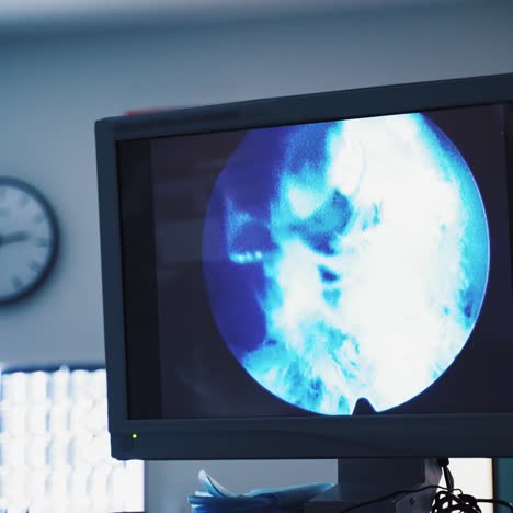 ultrasound scanning in x ray