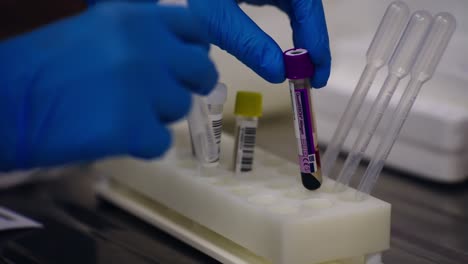 recogida de muestras de sangre en un laboratorio