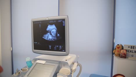 cita para el ultrasonido prenatal