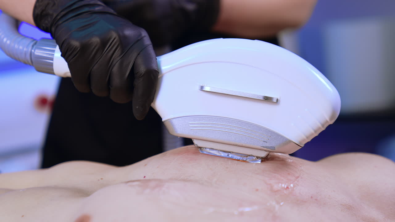 Modern laser equipment is moved by the male chest. Beauty specialist in black latex gloves removes hair. Close up.