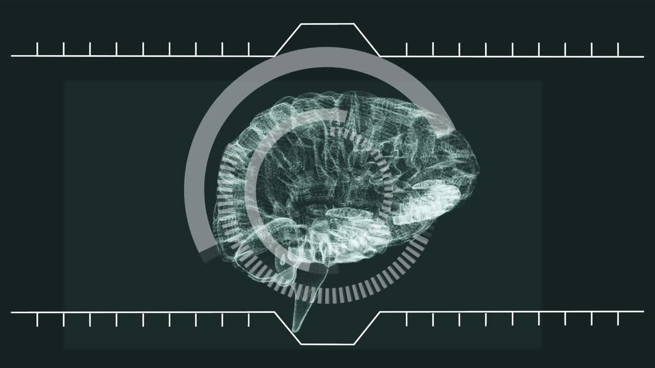 el cerebro gira a la izquierda con la información de análisis