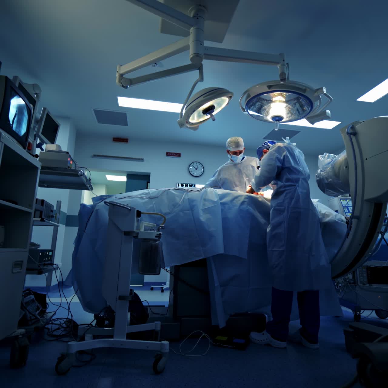 Medical specialists in modern operating room. Doctors perform a surgery and looking on the process on the monitor. Video from the top