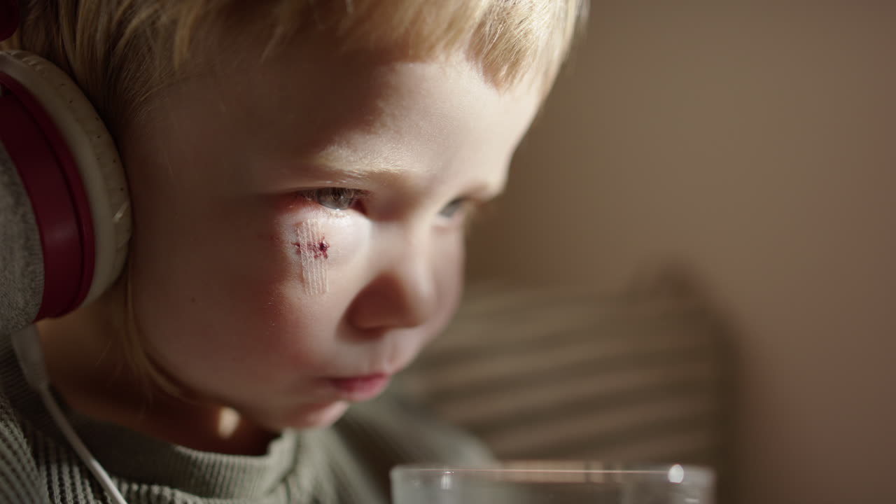 Toddler with black eye and cut with plaster over wears headphones drinks water